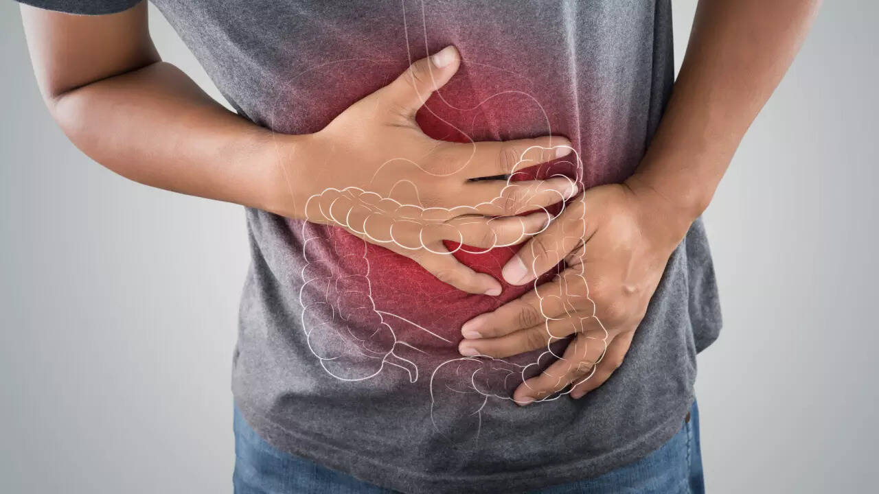 bowel cancer