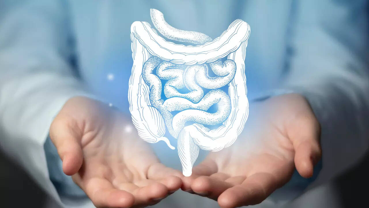 bowel cancer