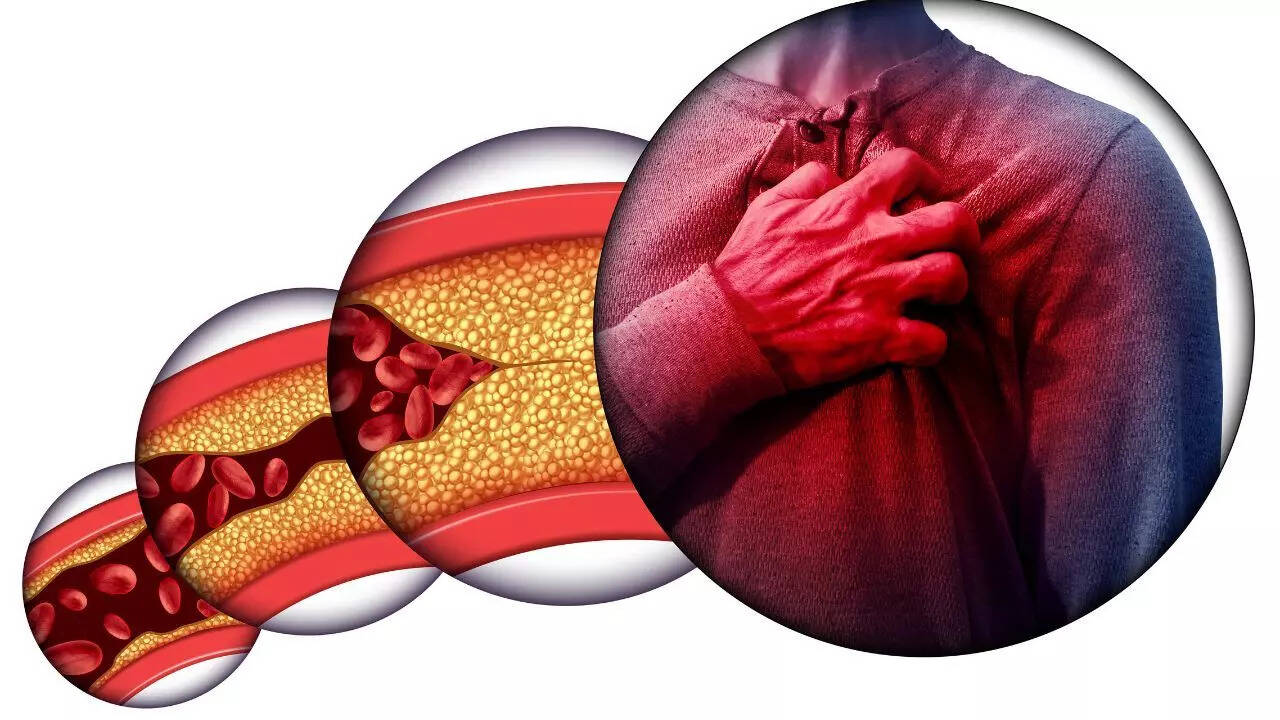 Changes that raise heart disease risk