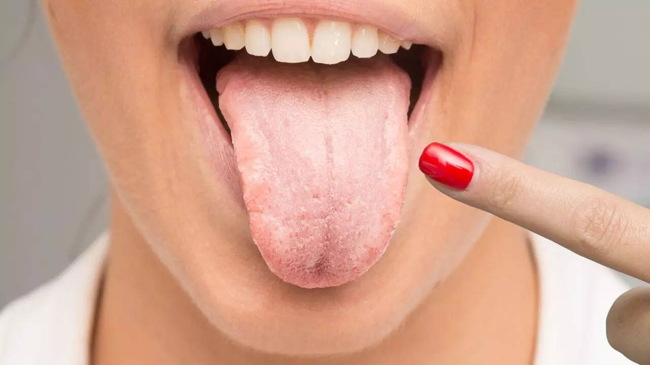 Red or white patches on tongue