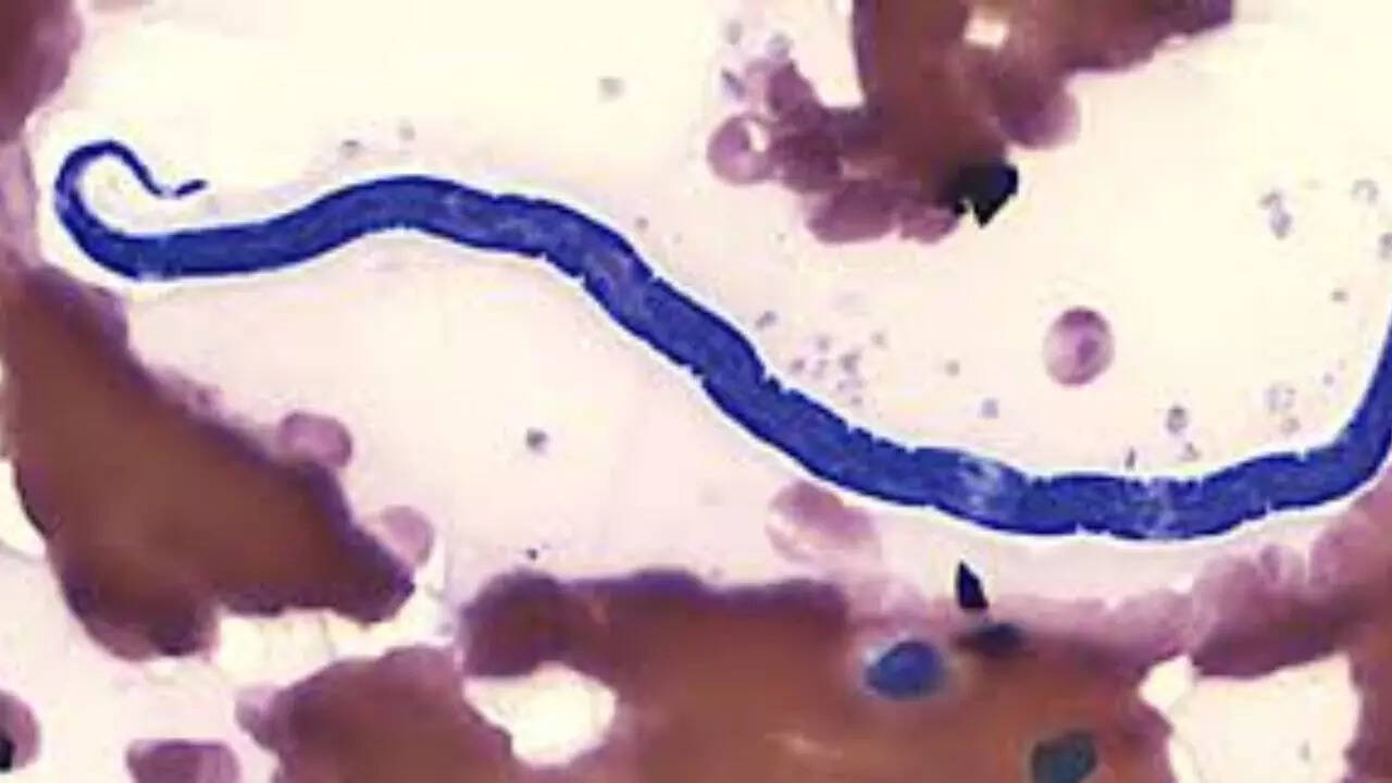 general ​African eye worm