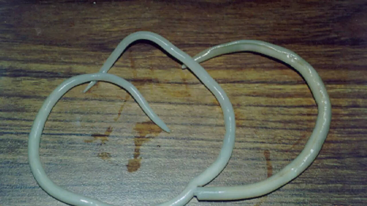 general Giant intestinal roundworm