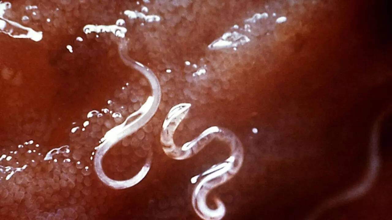 general Hookworms
