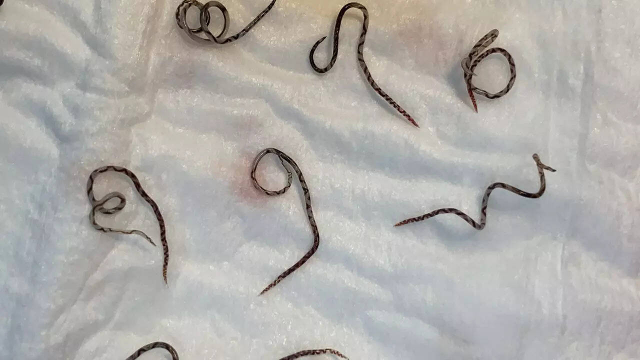 general Rat Lungworm