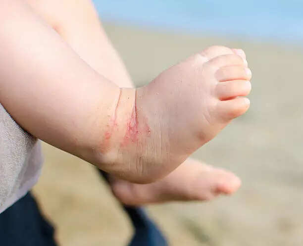 istockphoto-596089610-612x612