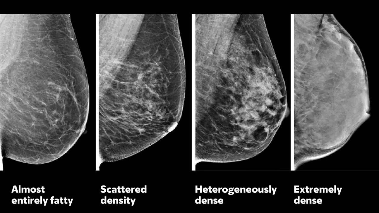 Breast cancer (19)