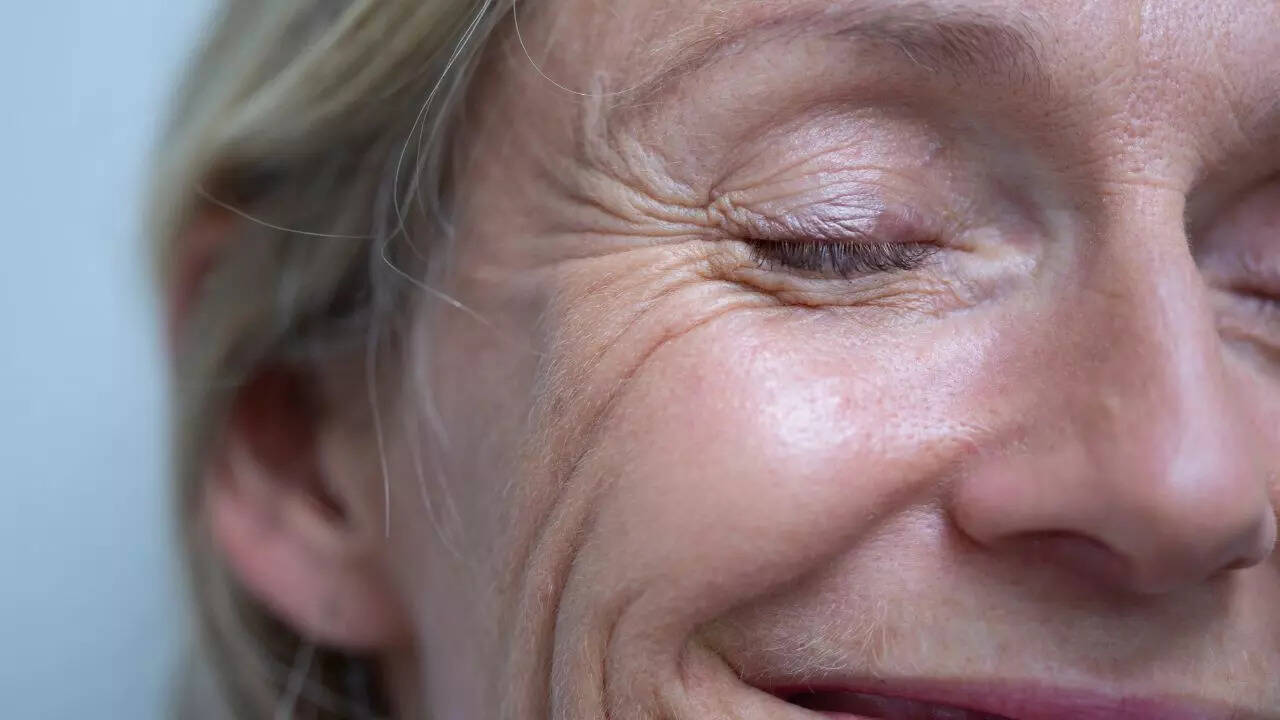 When to consult a dermatologist for smile lines