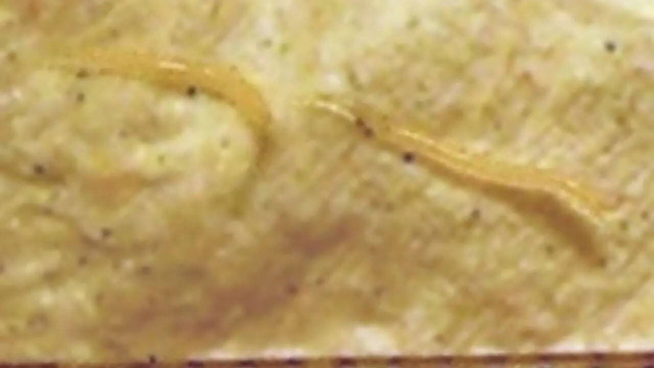 Wikipedia Pinworms
