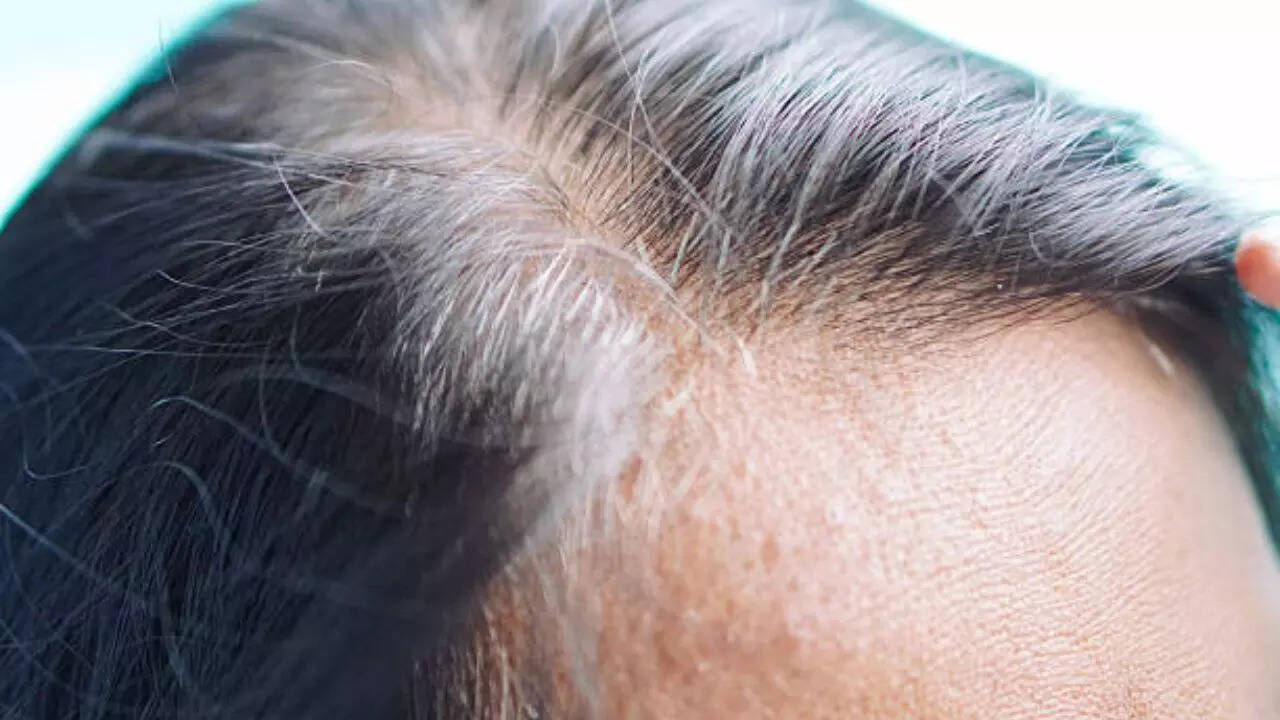 स्टेम सेल आबादी प्रतिकूल नियति का अनुसरण कर सकती है