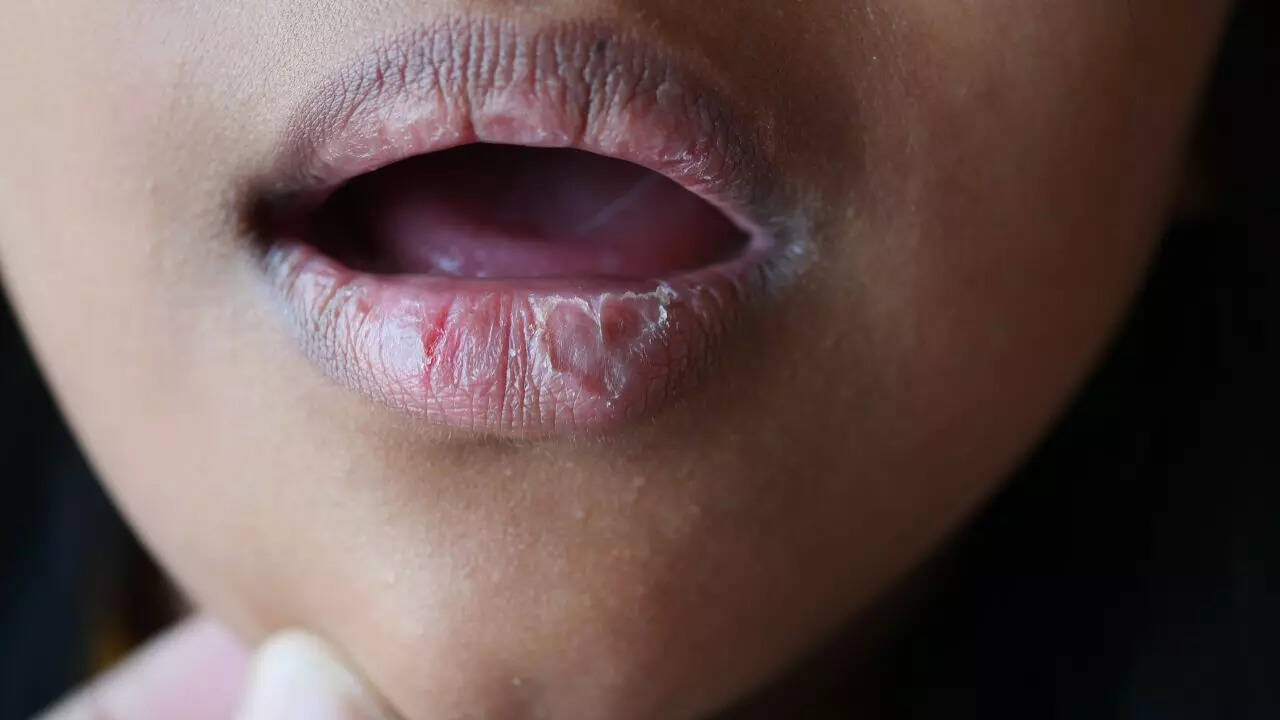 How your face shows hormone imbalance: 9 key signs to watch