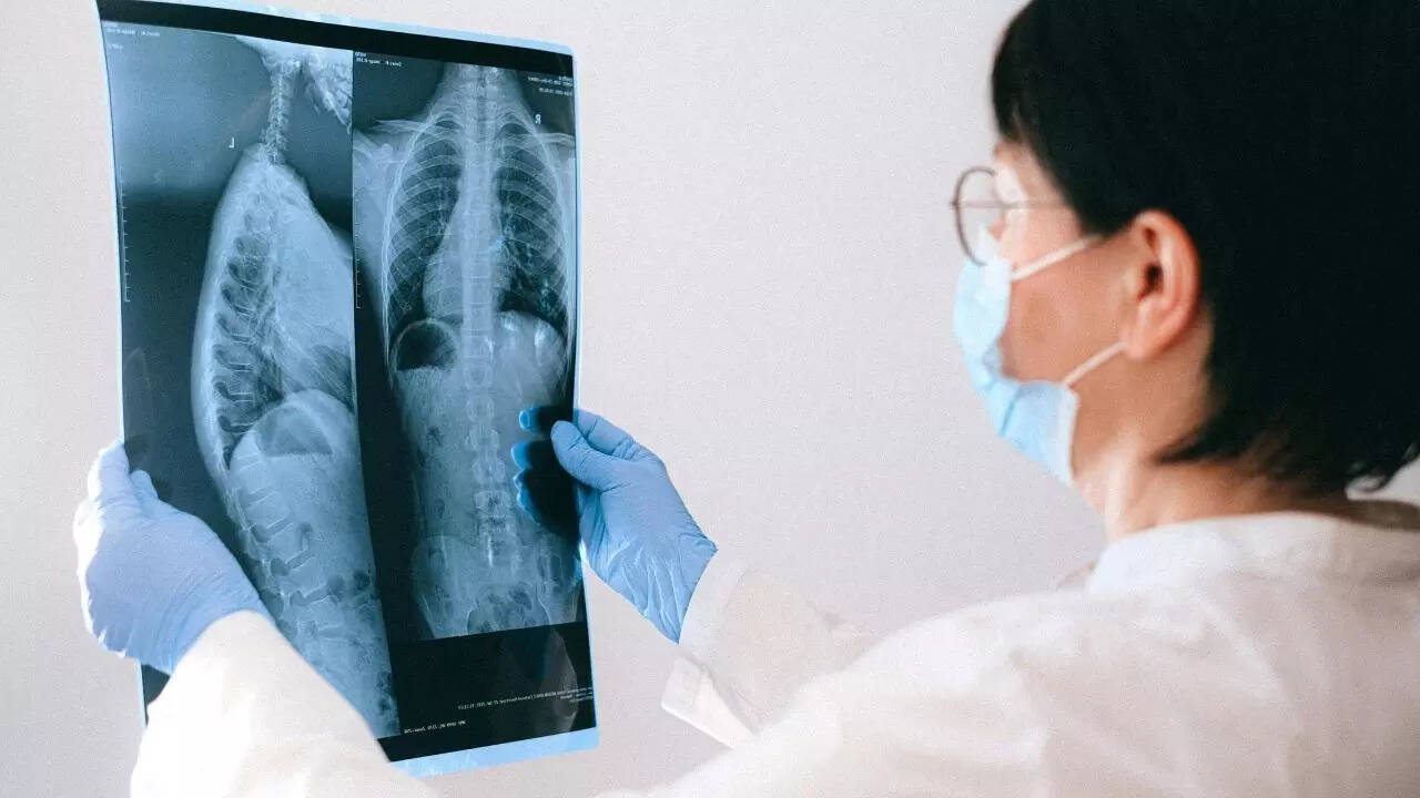 When are chest X-rays actually needed? (Image: Canva)