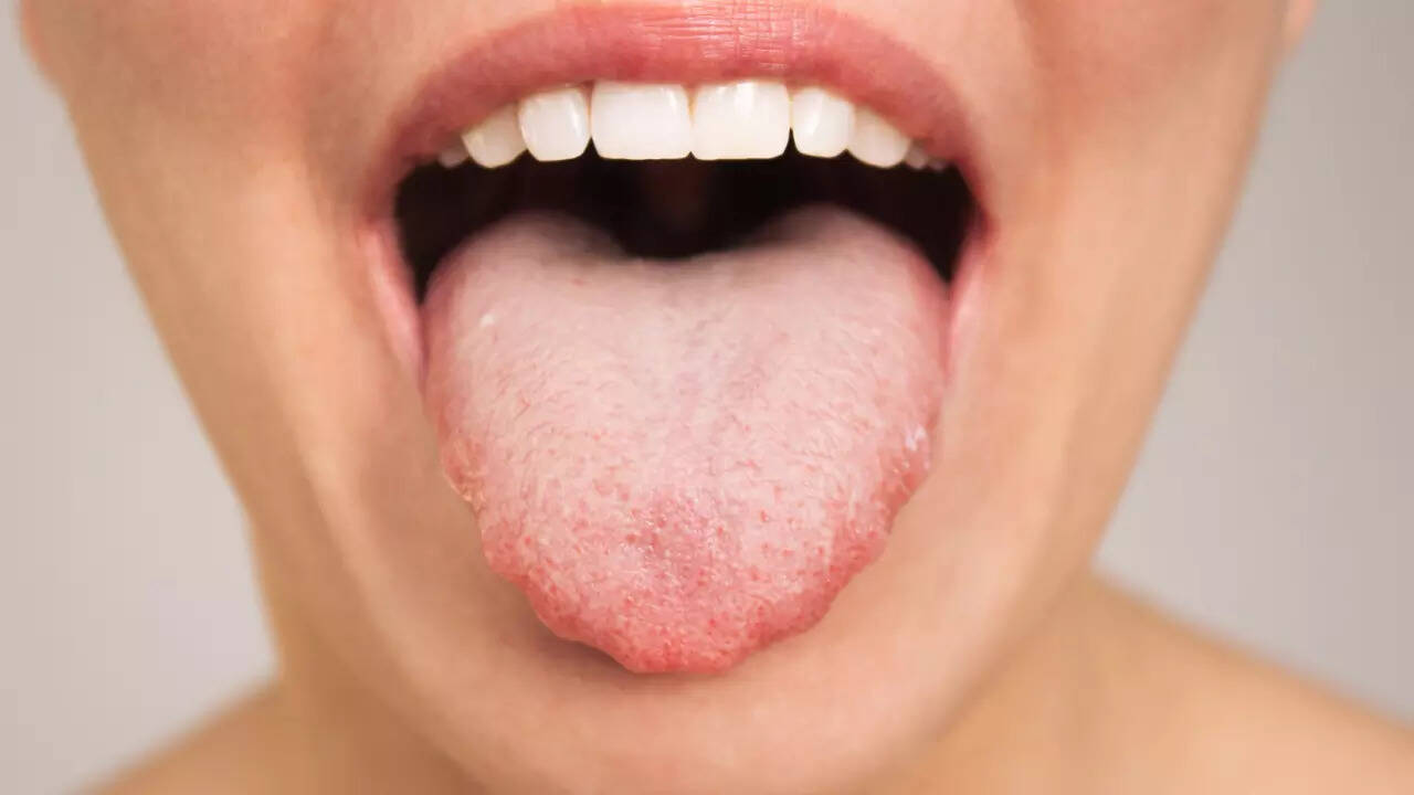 tongue