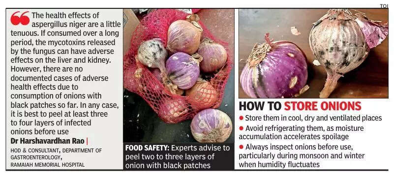 Debate over black patches on onions put to rest; it’s harmless if limited to outer layers: Bengaluru doctors