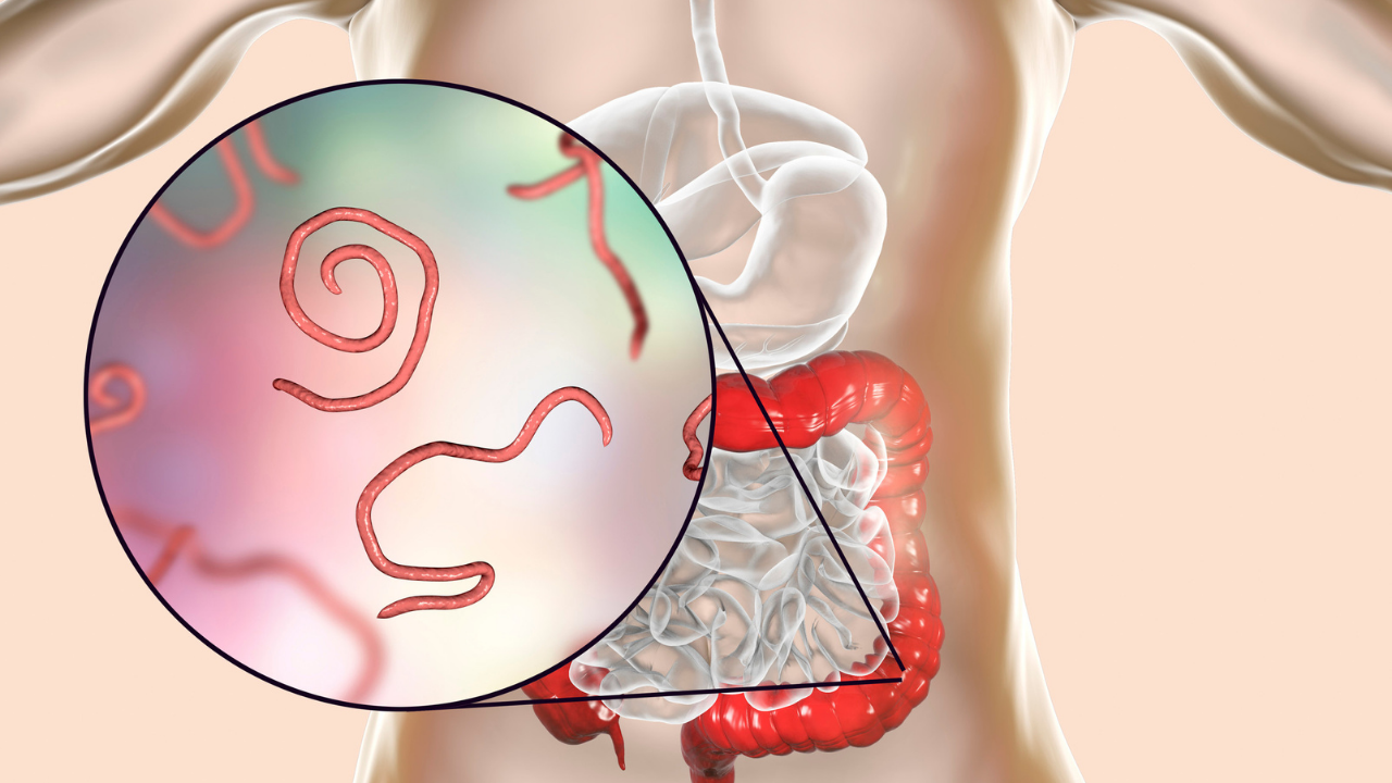 படம்: கேன்வா