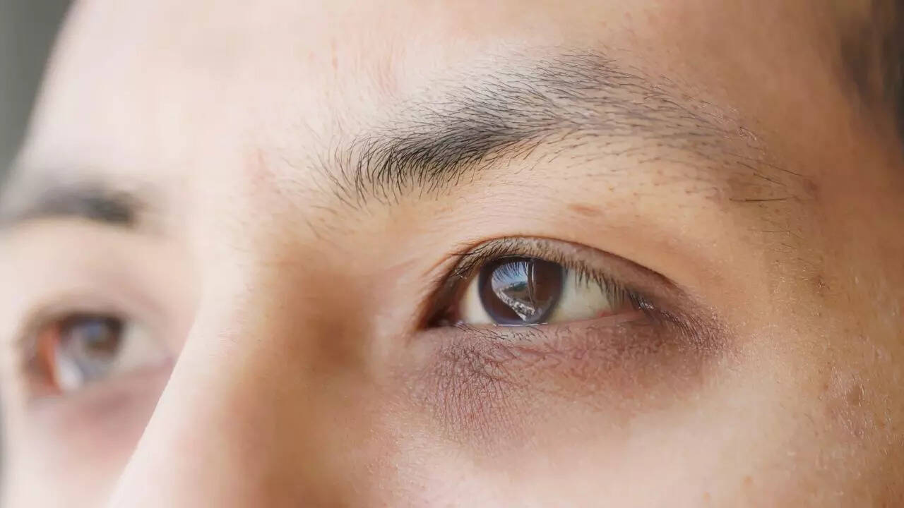 குளிர்காலத்தில் கருவளையங்களை கட்டுக்குள் வைத்திருக்க என்ன செய்யலாம்