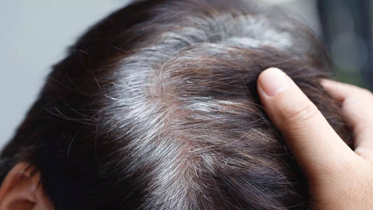Habits that prevent grey hair from getting dull