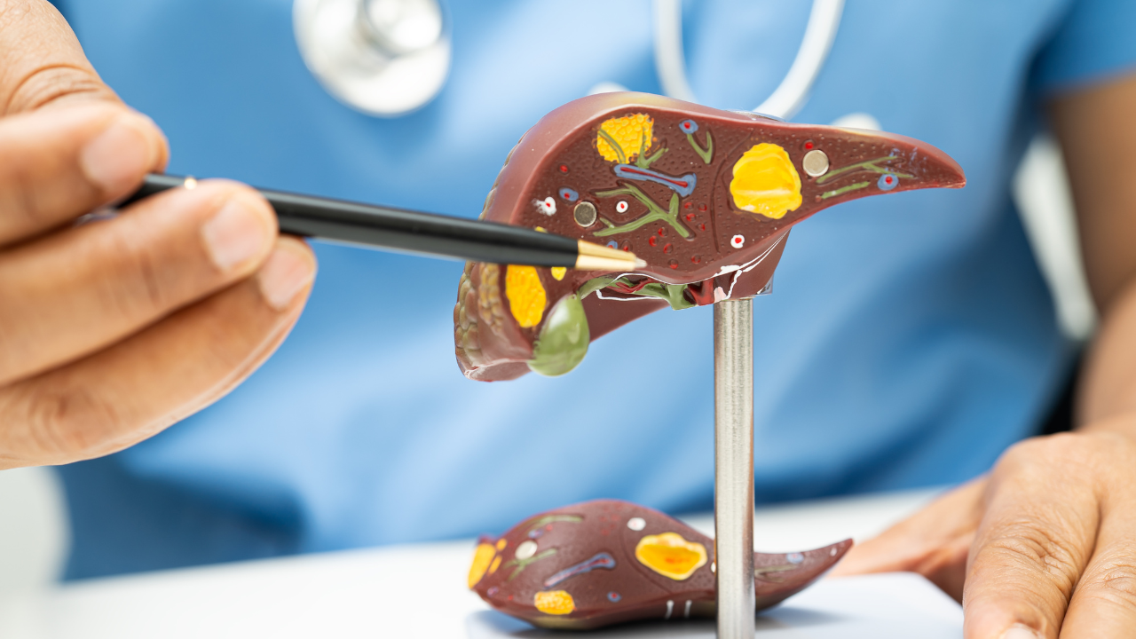 புகைப்படம்: கேன்வா