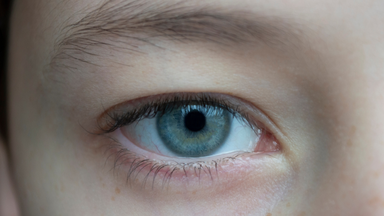 When a routine tooth extraction triggers a sight-threatening eye emergency days later 2 2