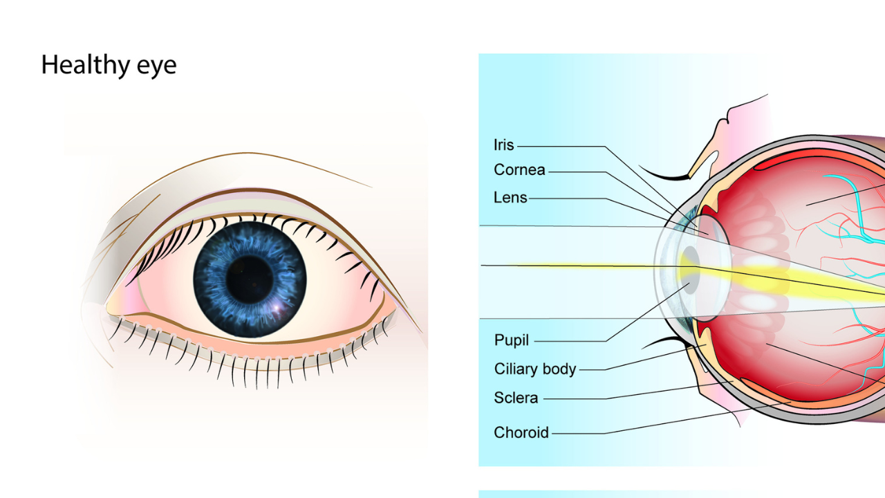 When a routine tooth extraction triggers a sight-threatening eye emergency days later 3 3