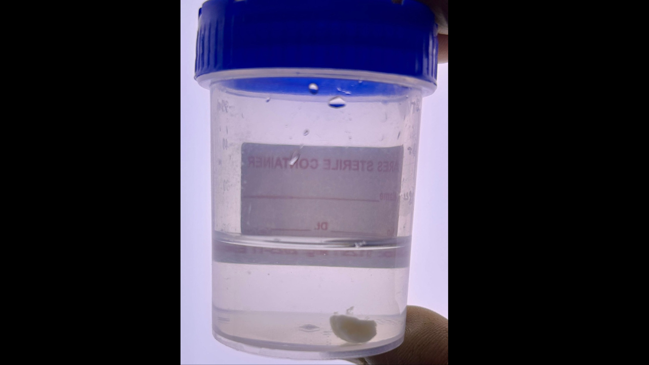  Two infants narrowly escape death in Faridabad