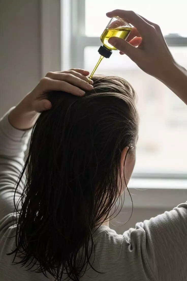 ​Why So Many Brides Lose Hair Before the Wedding And the One Ritual Doctors Swear By​