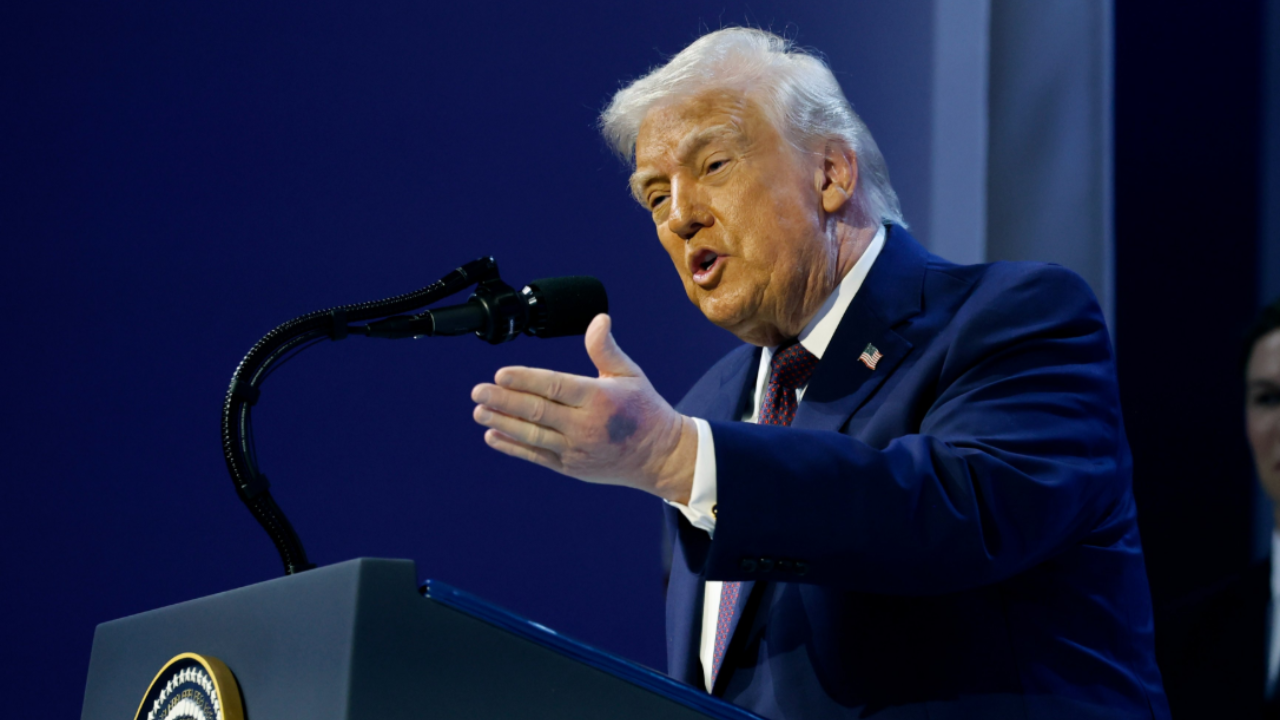 Trump diz que seu hematoma se deve ao aperto de mão de pessoas que conhece.