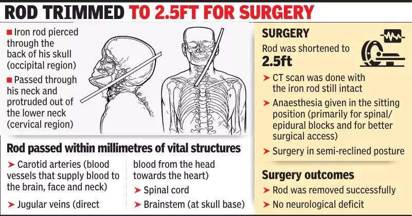 Rod misses brain and spine, no neurological deficits for patient