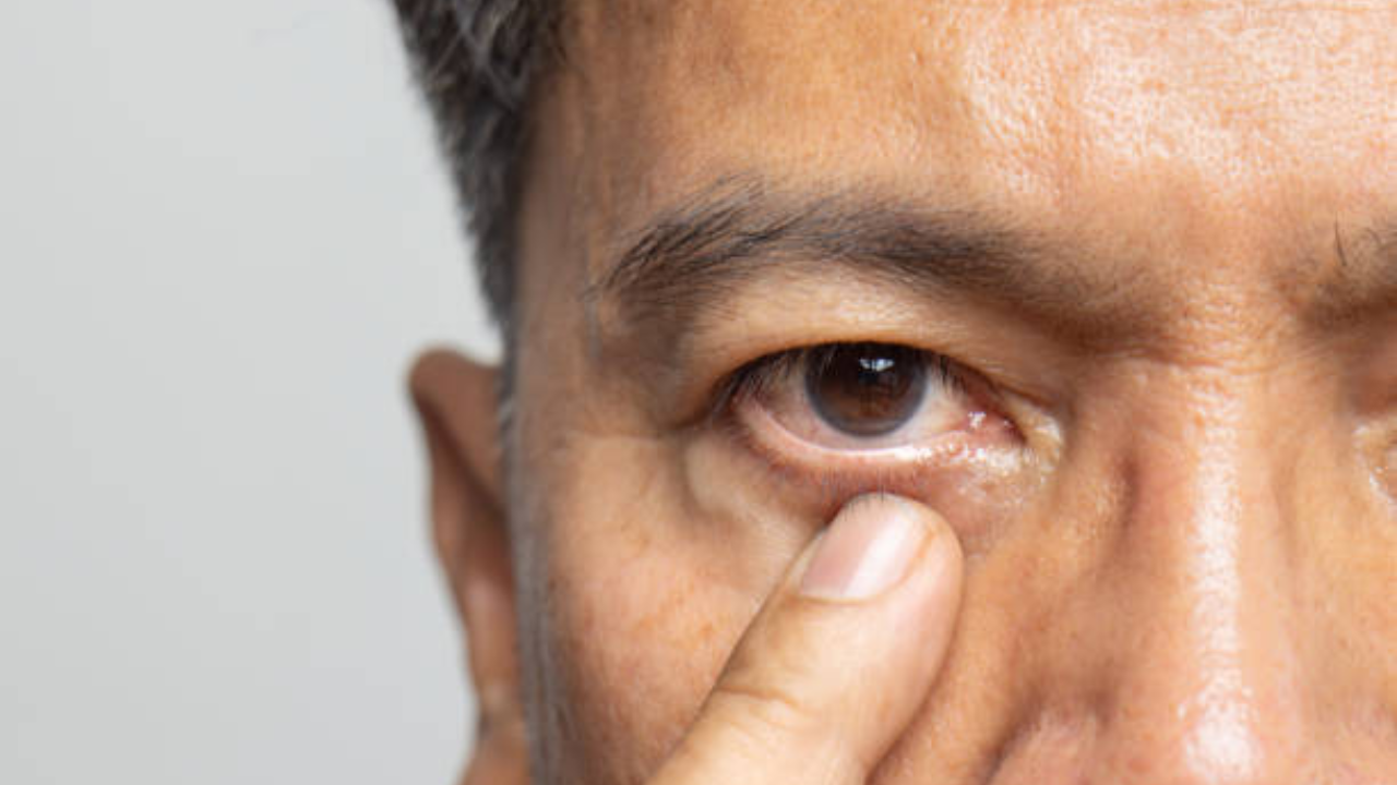 No glasses, no blur? You could still have glaucoma, experts reveal the symptoms and debunk myths