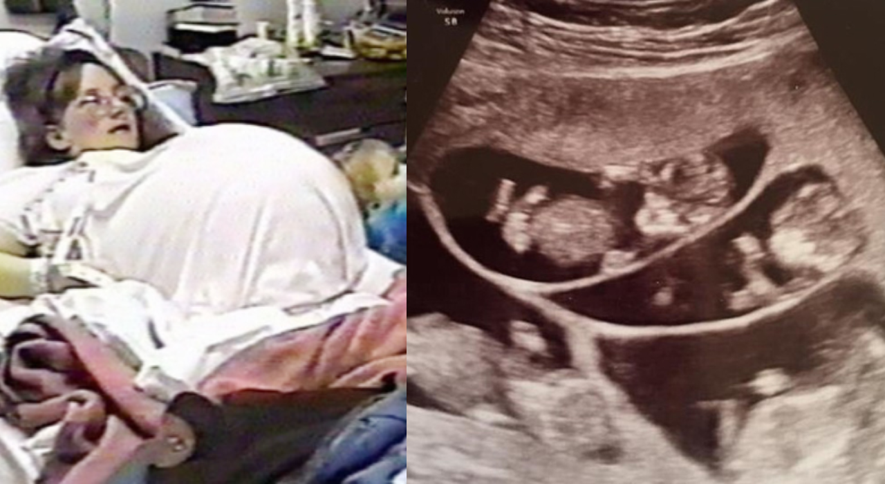 pregency தி McCaughey septuplets