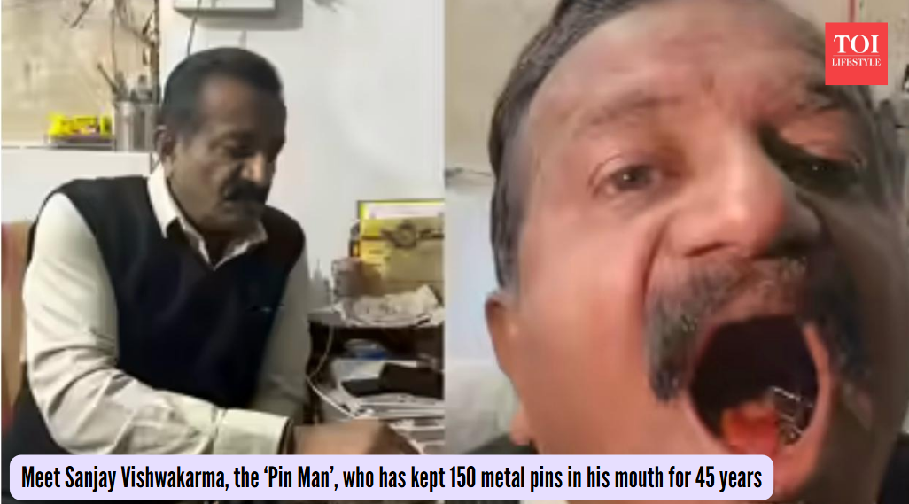 Meet Sanjay Vishwakarma, the ‘Pin Man’, who has kept 150 metal pins in his mouth for 45 years