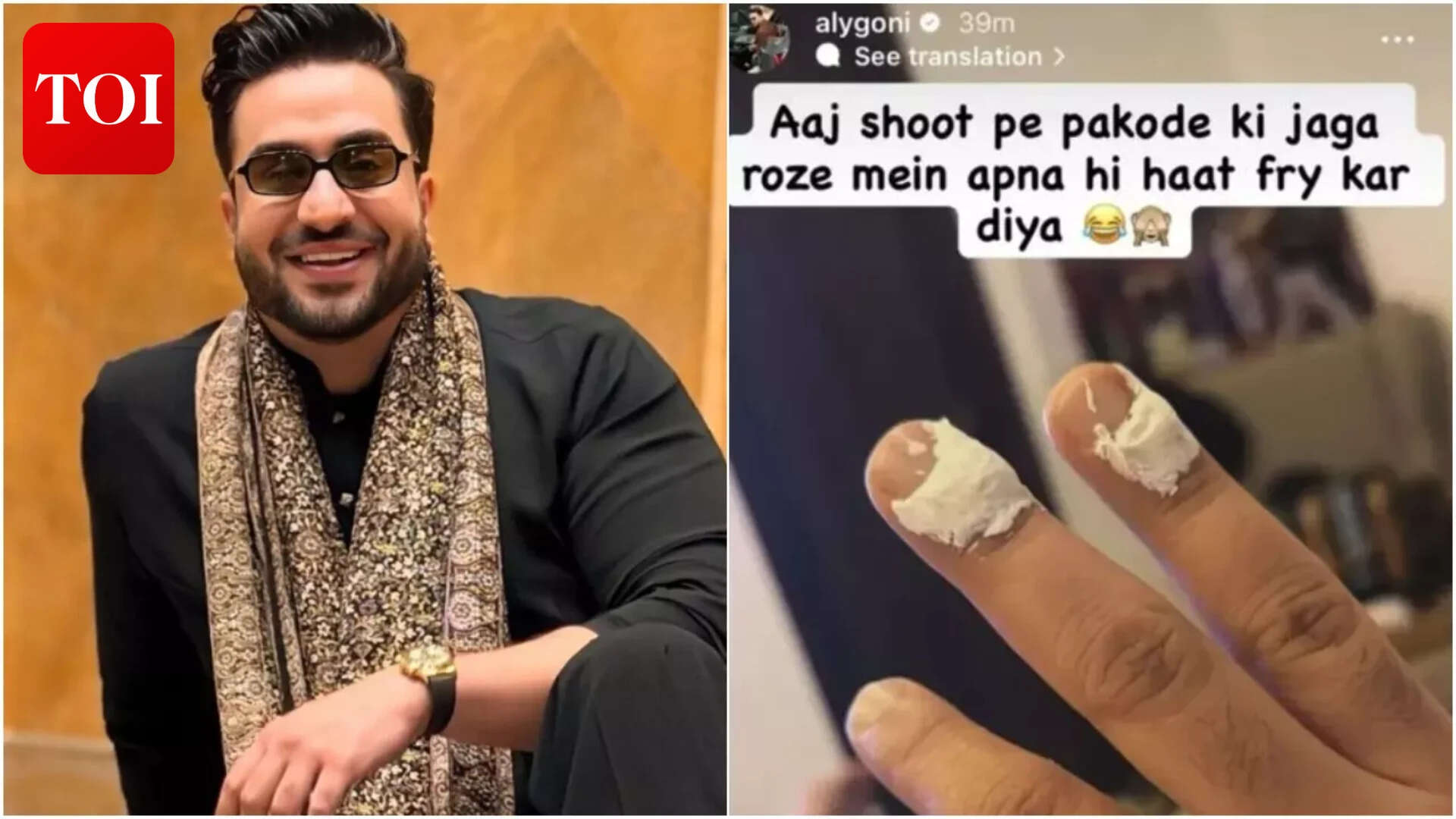 अली गोनी को लगी चोट