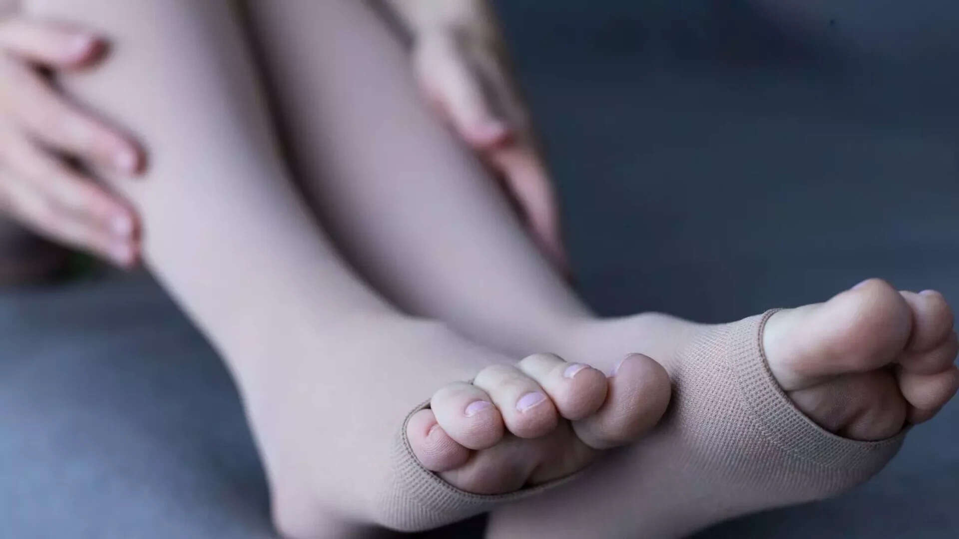 Doctors explain that conditions such as venous insufficiency, fluid retention, or prolonged inactivity can cause fluid buildup in the lower legs, making sock marks appear deeper. venous insufficiency