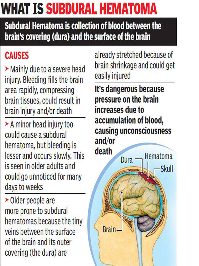 brain-skull