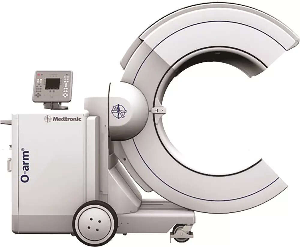 O-armTM system