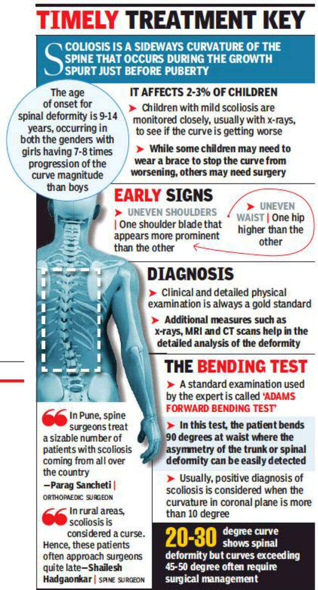 Ignoring spinal curve can cost dear, warn experts Pune News Times