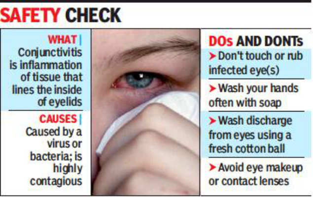 Madras Eye Infection ‘madras Eye Is Back With Fever Cough Chennai News Times Of India 8723