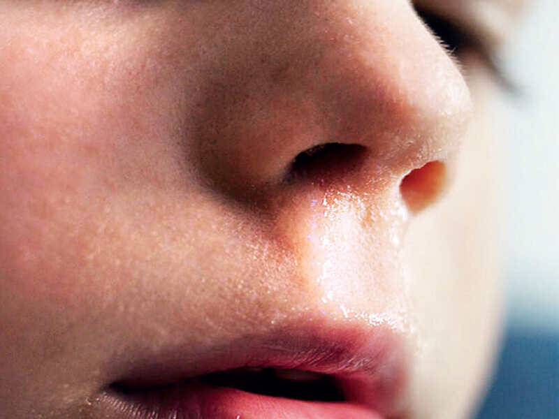 From runny nose to brain fluid leak