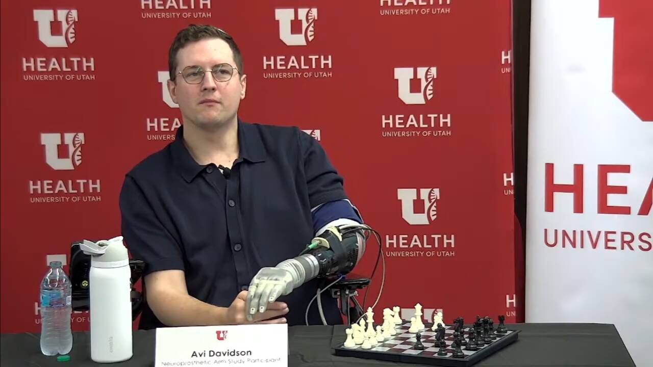 Thought-controlled bionic arm gives man his sense of touch back