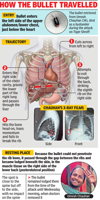 How the bullet travelled<br>