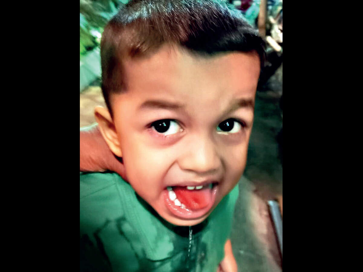 Bizarre! Four-year-old boy served washing soda to eat instead of sugar at a local restaurant, tongue burnt - Vimarsana News