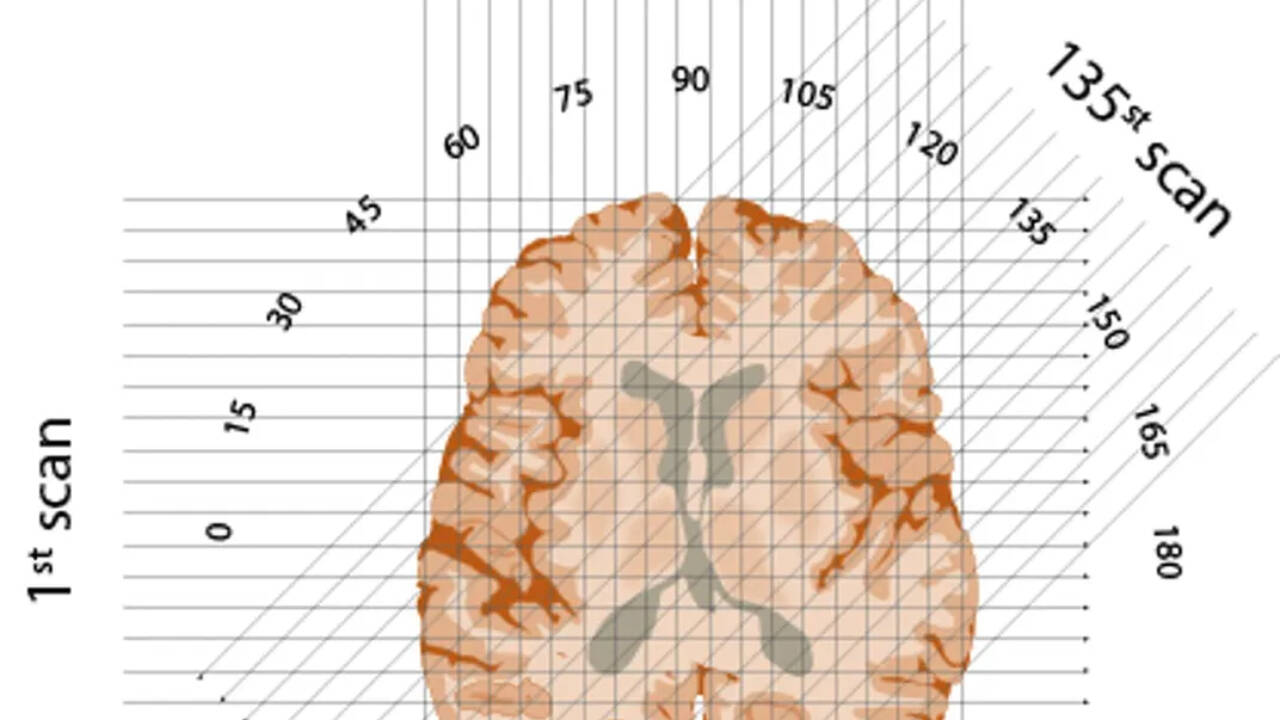 X-rays beam through each ‘slice’ of brain, oriented at each degree from 1 to 180 in a semicircle<br>
