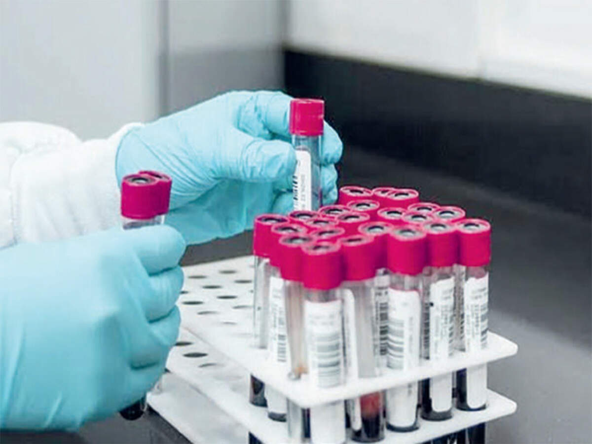 Hackathon to simplify covid swab logistics - Vimarsana News