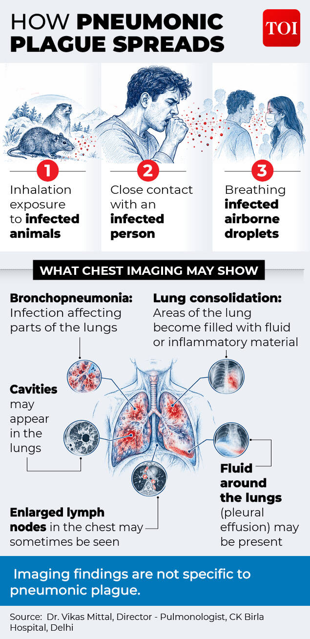 how pneumonic plague spreads