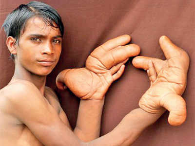 Boy with giant hands branded the devil