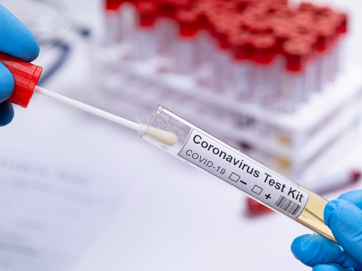 Coronaviruses related to pandemic virus found in lab freezers: Study