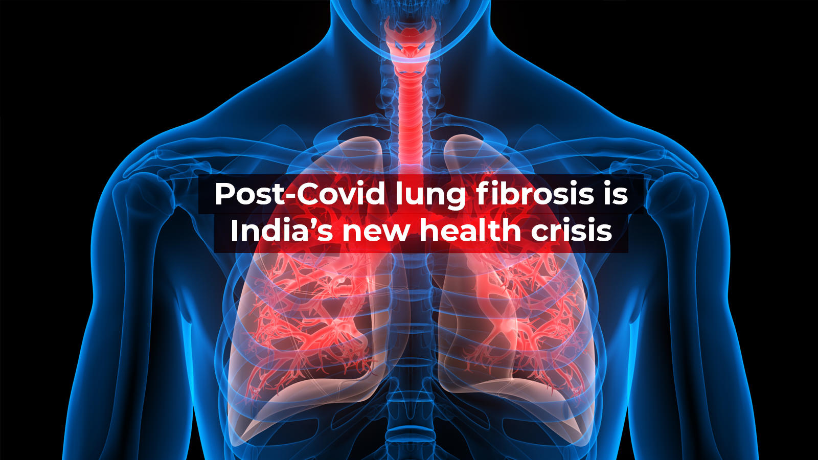 Post-Covid Lung Fibrosis Is India’s New Health Crisis - Times Of India