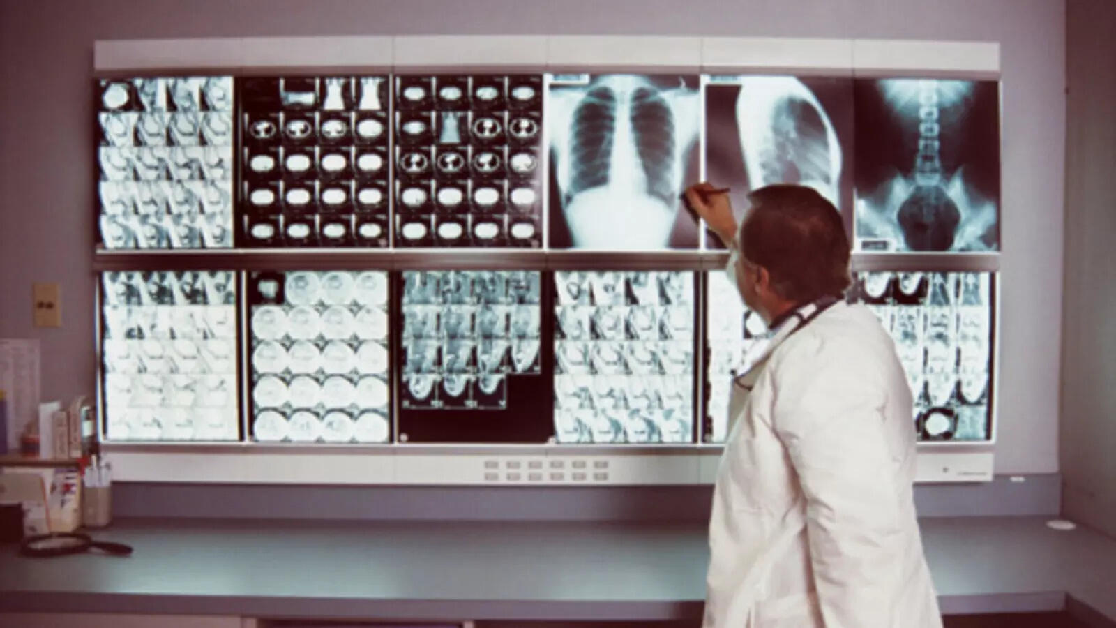 World Radiology Day: 10 issues to know should you want to pursue a ...