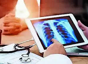 UP govt traces 6 lakh hidden TB cases | Lucknow News – Times of India