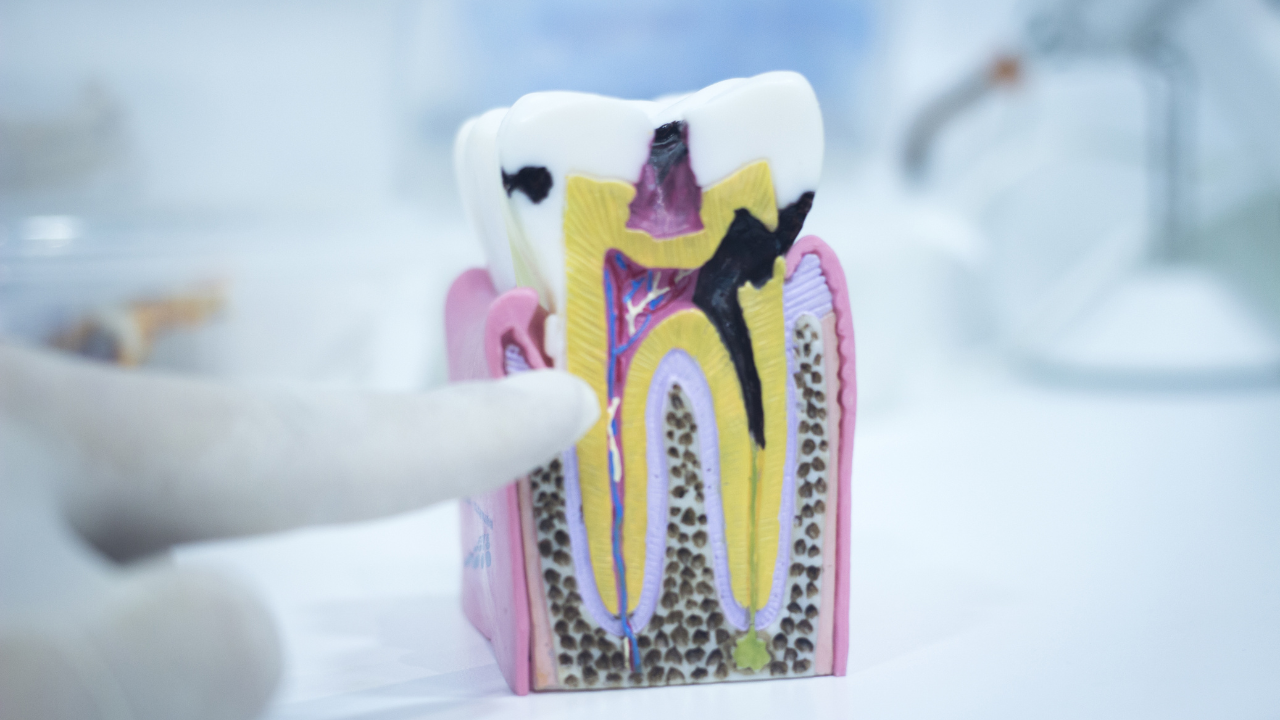 oral  (2)