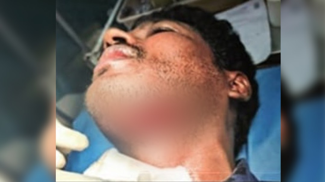 Drunk man slashes doctor’s throat at govt hospital